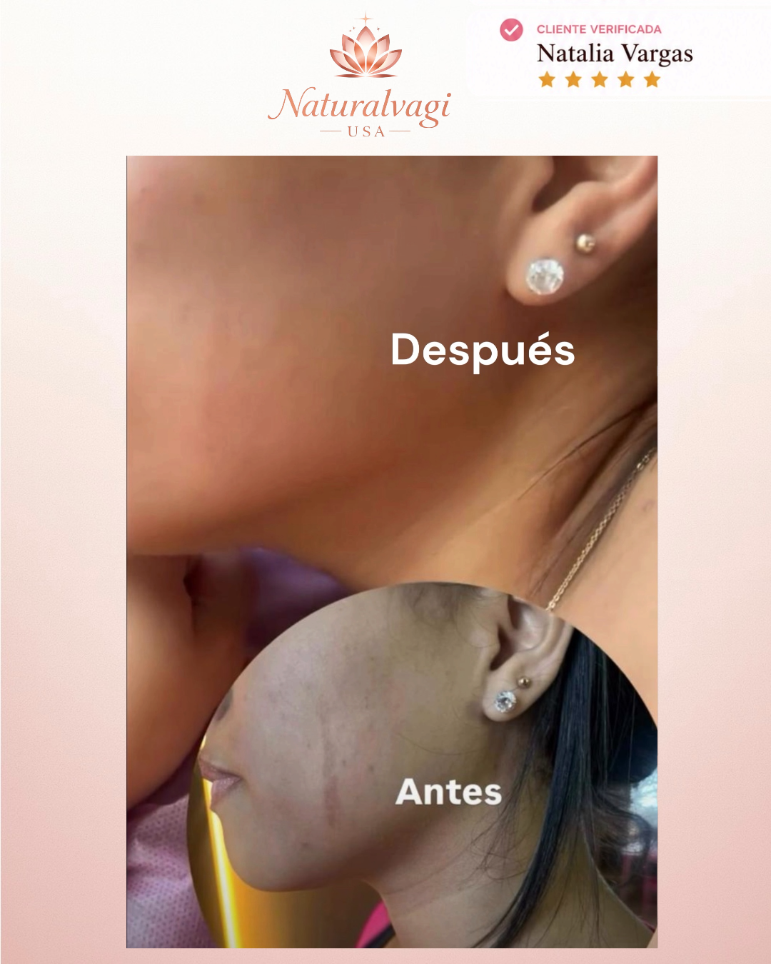 Testimonio