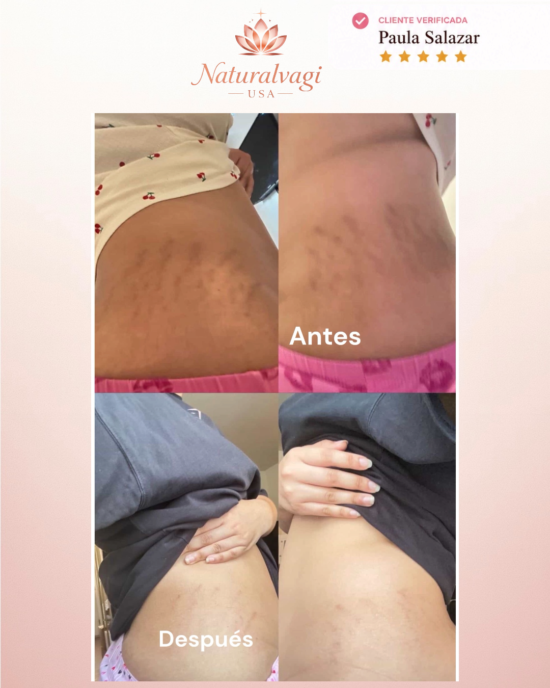 Testimonio