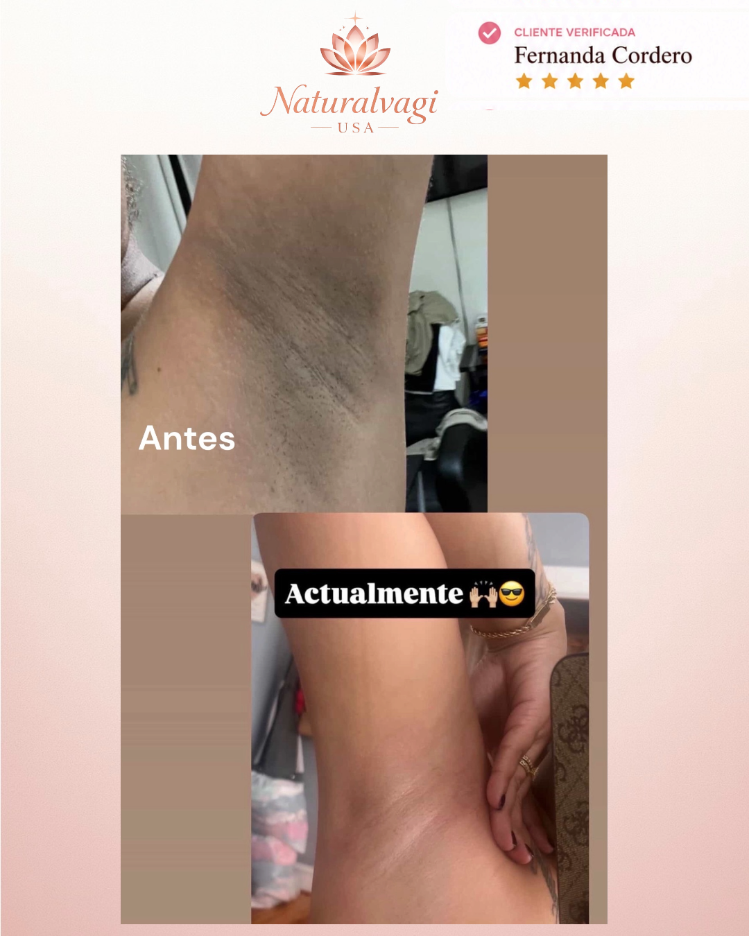 Testimonio