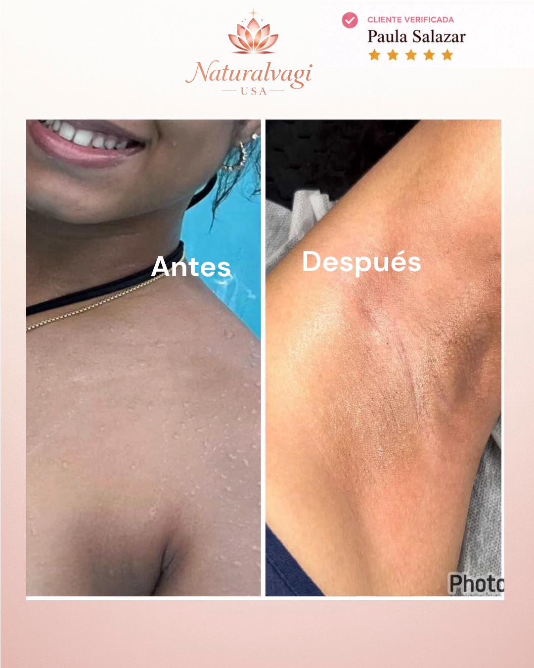 Testimonio